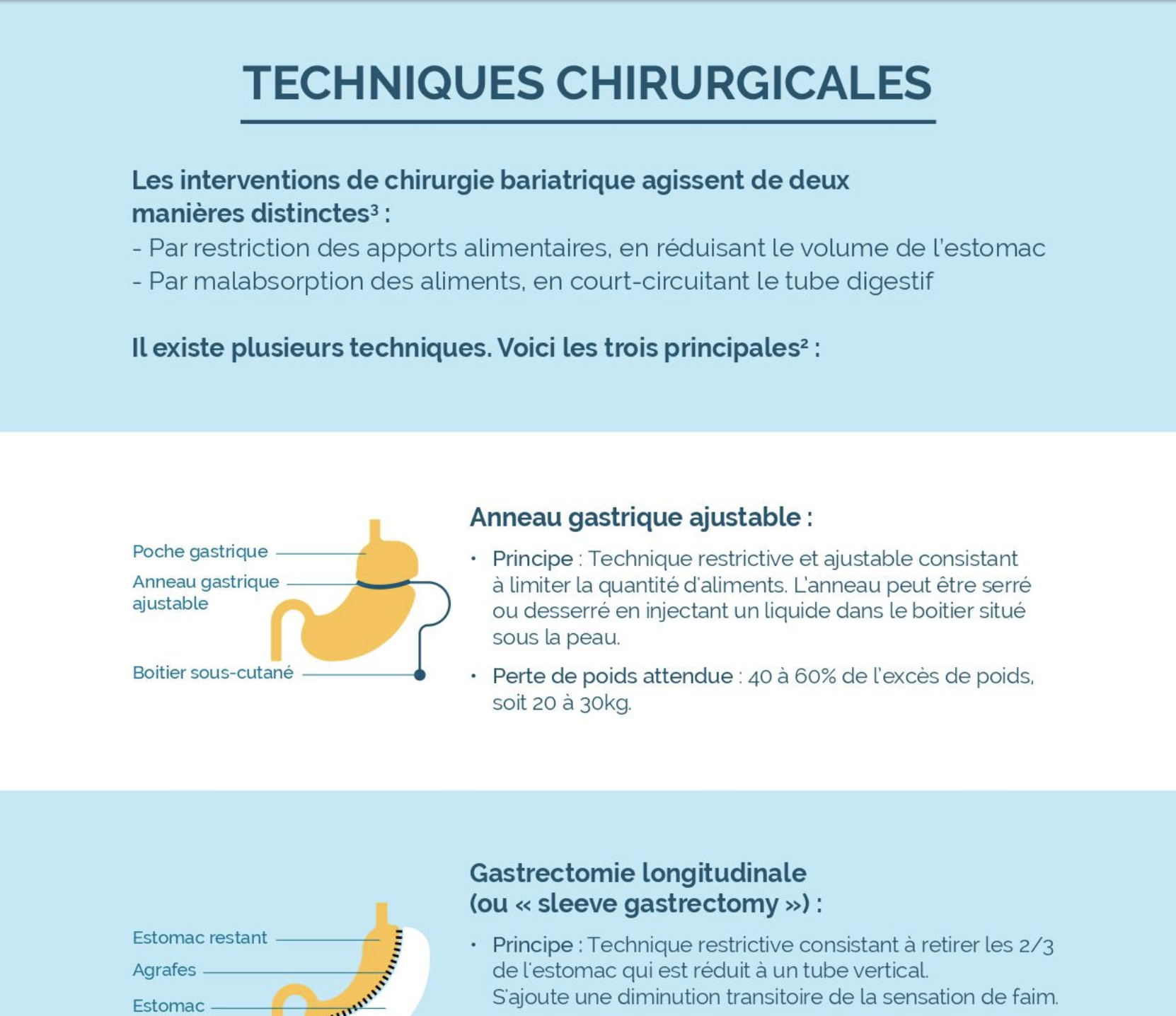 La chirurgie bariatrique 