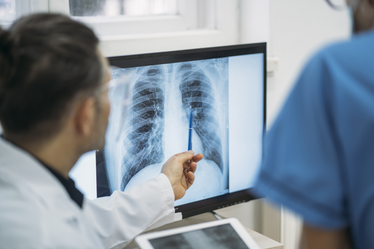 Moins de rayons X pour les patients lors d'un scanner