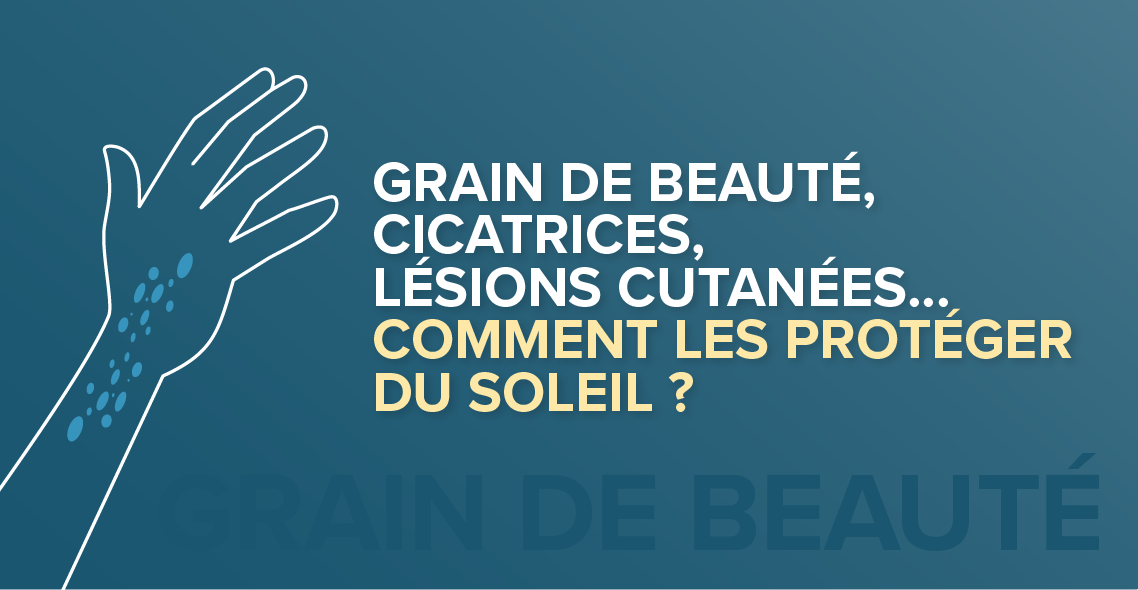 Grains de beauté, lésions cutanées, cicatrices… comment les protéger du soleil ?