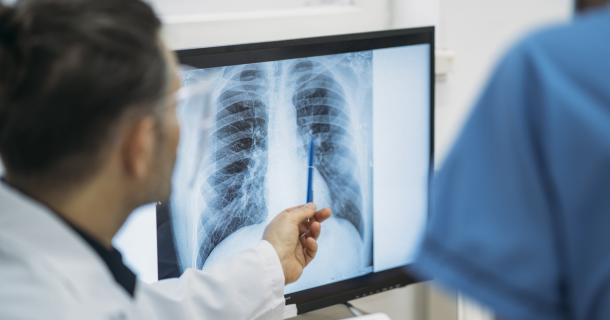 Moins de rayons X pour les patients lors d'un scanner